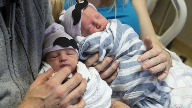Twins Born Just 10 Minutes Apart Were Born On Different Days In Different Years 
