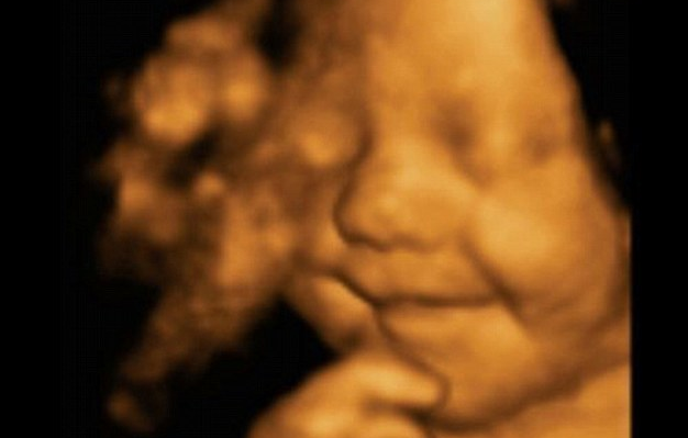 New Bill Would Ban Abortions Nationwide When Unborn Baby’s Heart Begins Beating