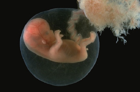 Alabama Correctly Ruled That Human Embryos are People, Not Property
