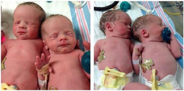 moms-posts-of-their-premature-babies-expose-how-abortion-is-legal-up