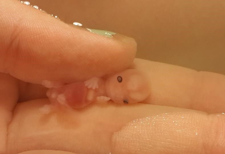 incredible-photos-of-babies-miscarried-at-7-and-8-weeks-prove-the