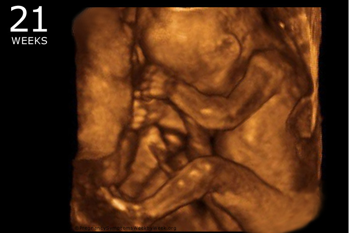 12,000 Viable Babies are Killed in Late-Term Abortions in America Every Year