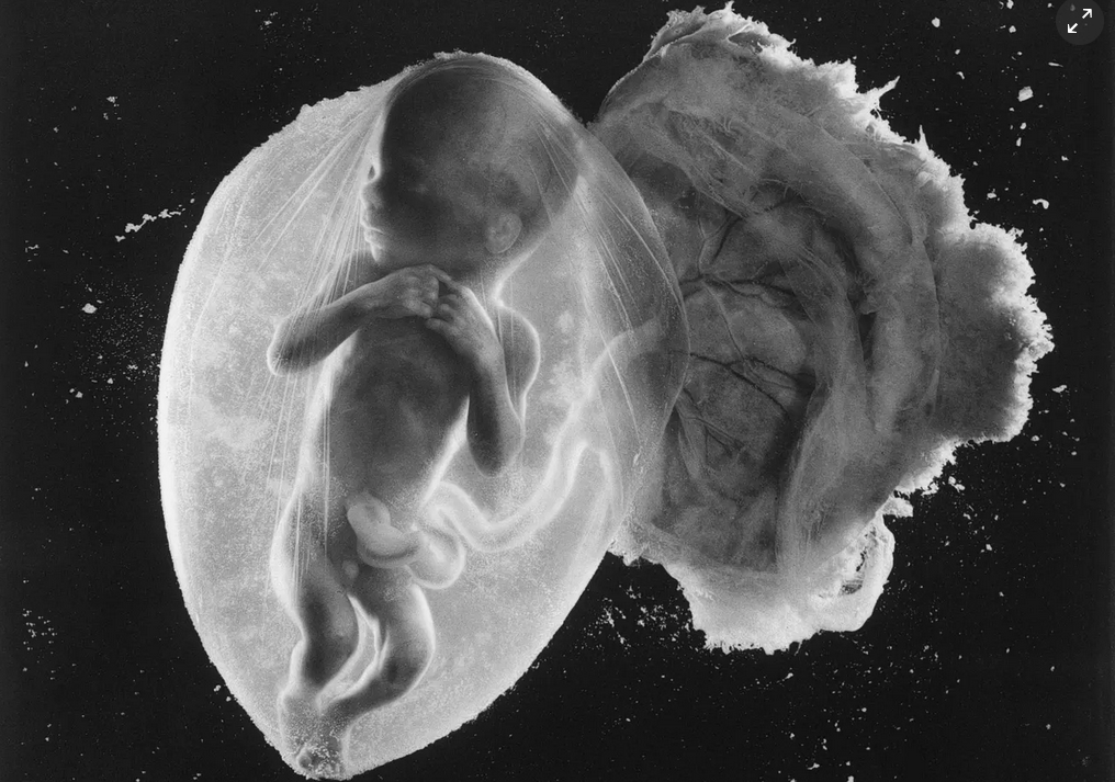 Amazing Image of Unborn Baby at 18 Weeks is Called the Photograph of ...