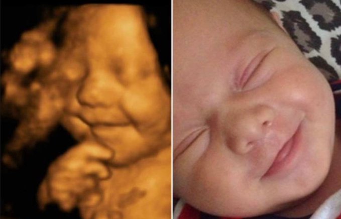 Killing Unborn Human Beings is Wrong, Whether It’s Abortion or IVF