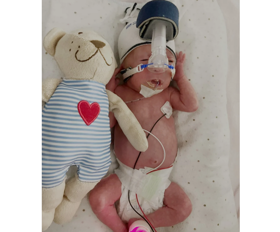 Premature Baby Born at 29 Weeks, Same Size as Her Teddy Bear, Heads Home